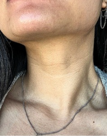 Before - De verdad me hace sentir mejor cada día.